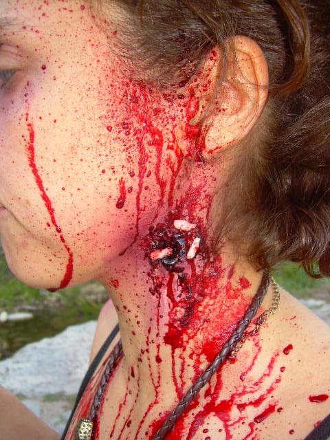 bullet-wound-with-maggots_0.